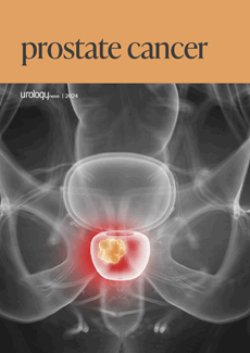 Prostate Cancer 2024