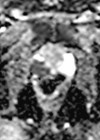 Image showing MRI scan.